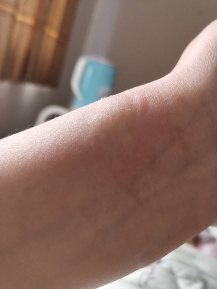 后来我家老爷子买荣耀8x max送了一个a2手环给我了 一戴又过敏 看来